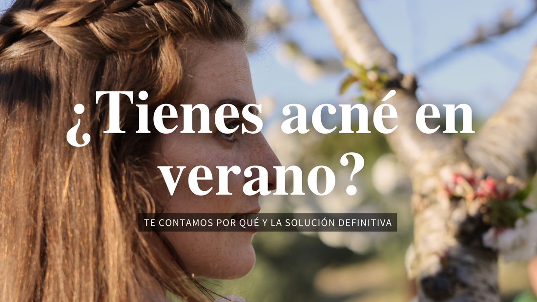 ¿Cuáles son los motivos del acné en verano?