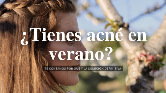 ¿Cuáles son los motivos del acné en verano?