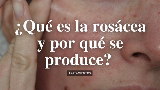 ¿Qué es la rosácea y por qué se produce? Tratamientos