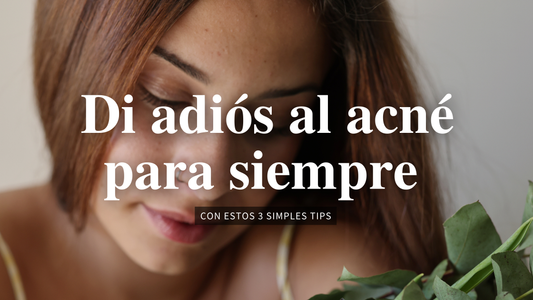Di adiós al acné para siempre con estos 3 tips
