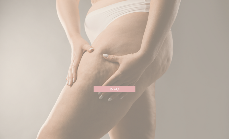 Cellulite and stretch marks: normalize, care for, and be consistent (without impossible promises)