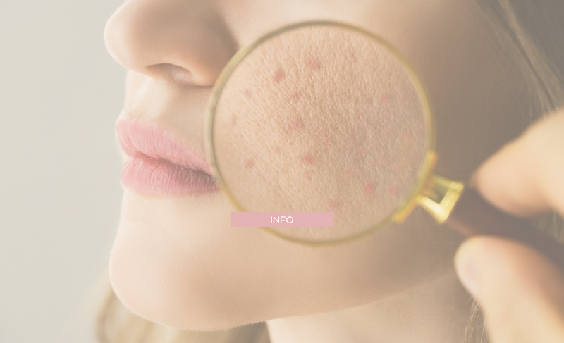 How to know what type of skin you have and what each one needs