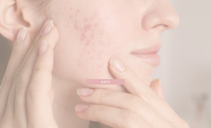 Skincare y hormonas: cómo cuidar tu piel según tu ciclo (y por qué noviembre es el mes ideal para empezar)